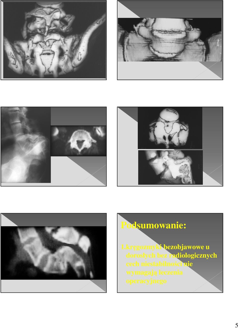 dorosłych bez radiologicznych