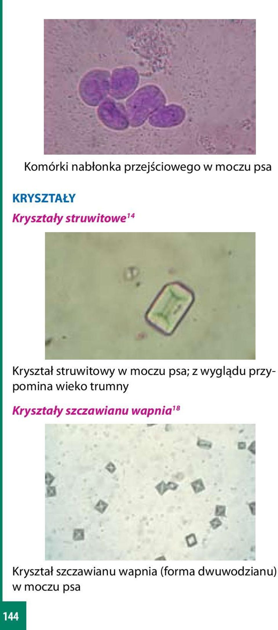 wyglądu przypomina wieko trumny Kryształy szczawianu wapnia