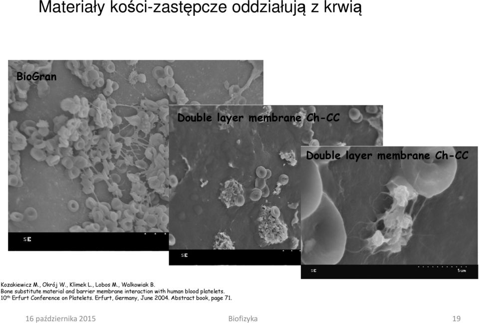 Bone substitute material and barrier membrane interaction with human blood platelets.