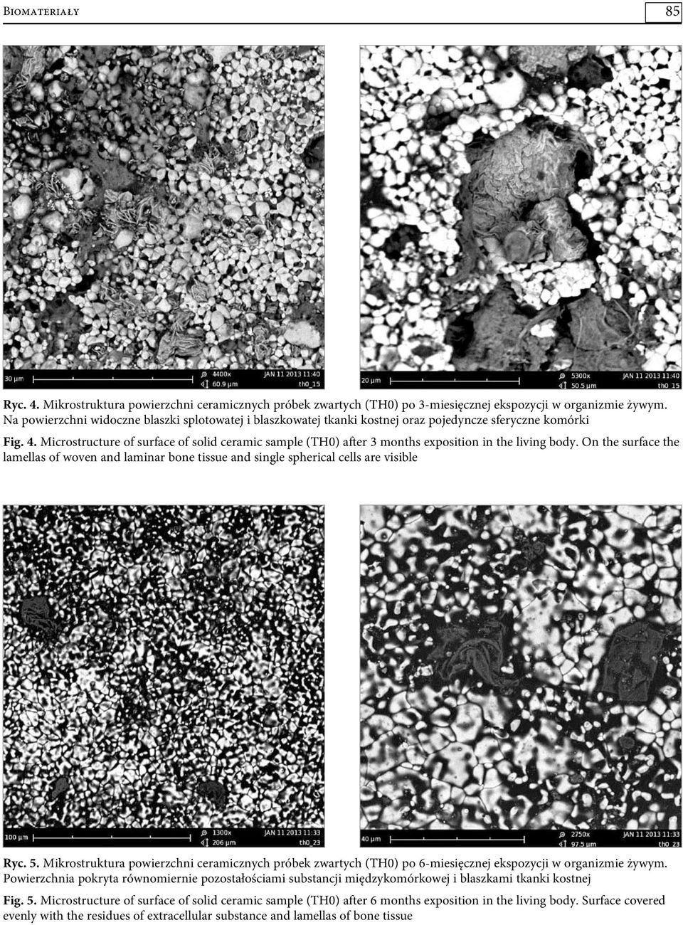 Microstructure of surface of solid ceramic sample (TH0) after 3 months exposition in the living body.