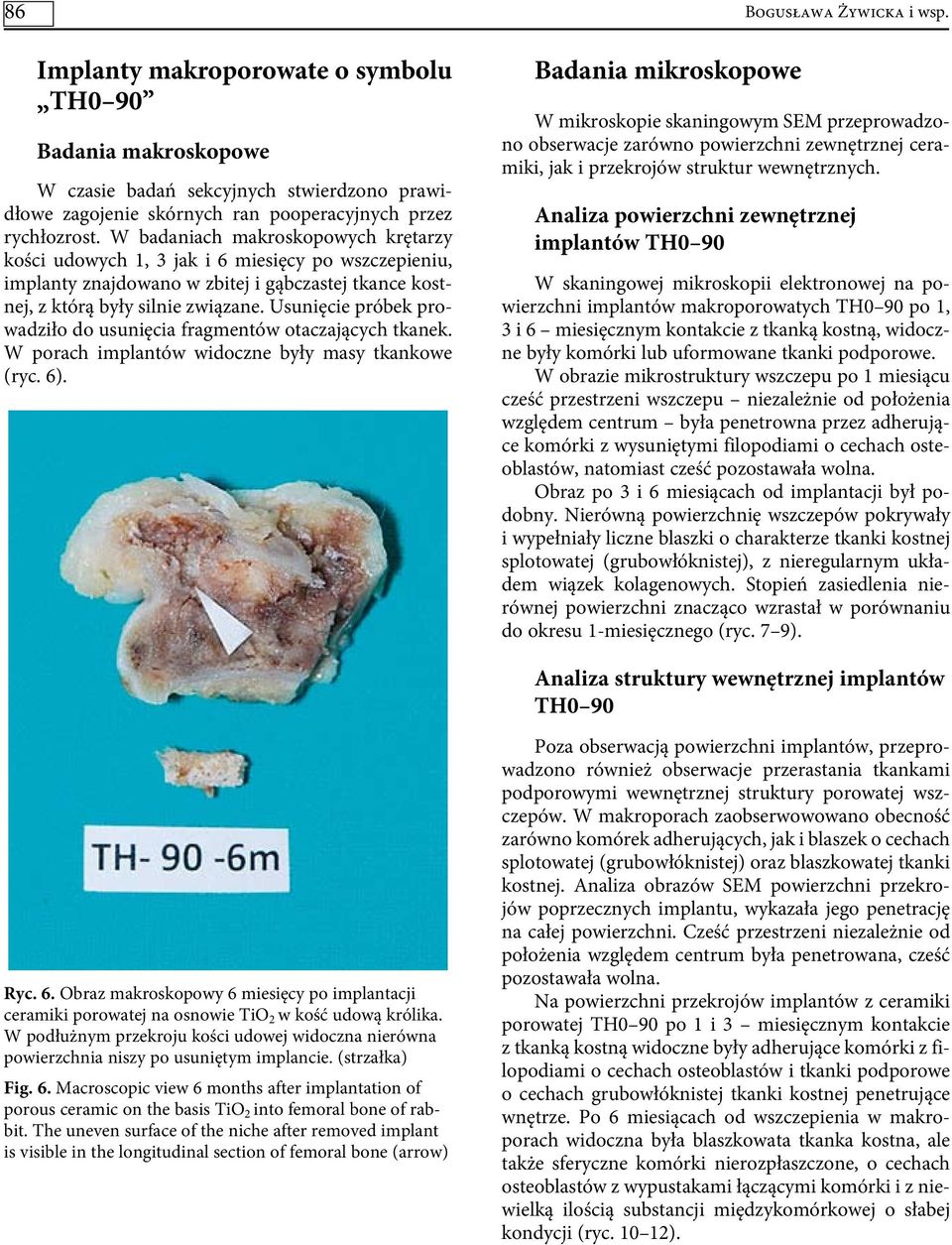 Usunięcie próbek prowadziło do usunięcia fragmentów otaczających tkanek. W porach implantów widoczne były masy tkankowe (ryc. 6). Badania mikroskopowe Bogusława Żywicka i wsp.