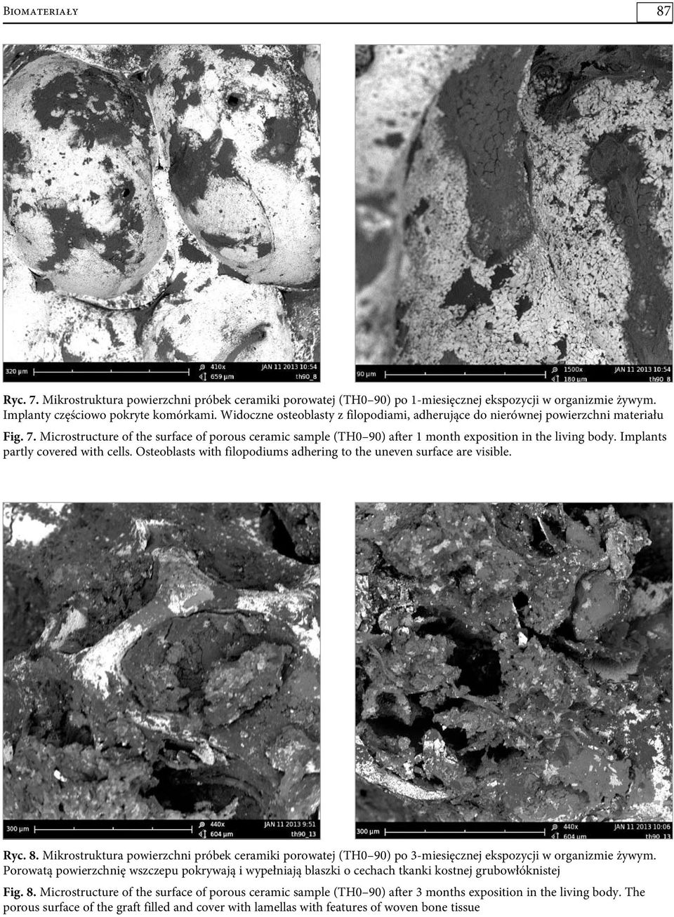Implants partly covered with cells. Osteoblasts with filopodiums adhering to the uneven surface are visible. Ryc. 8.