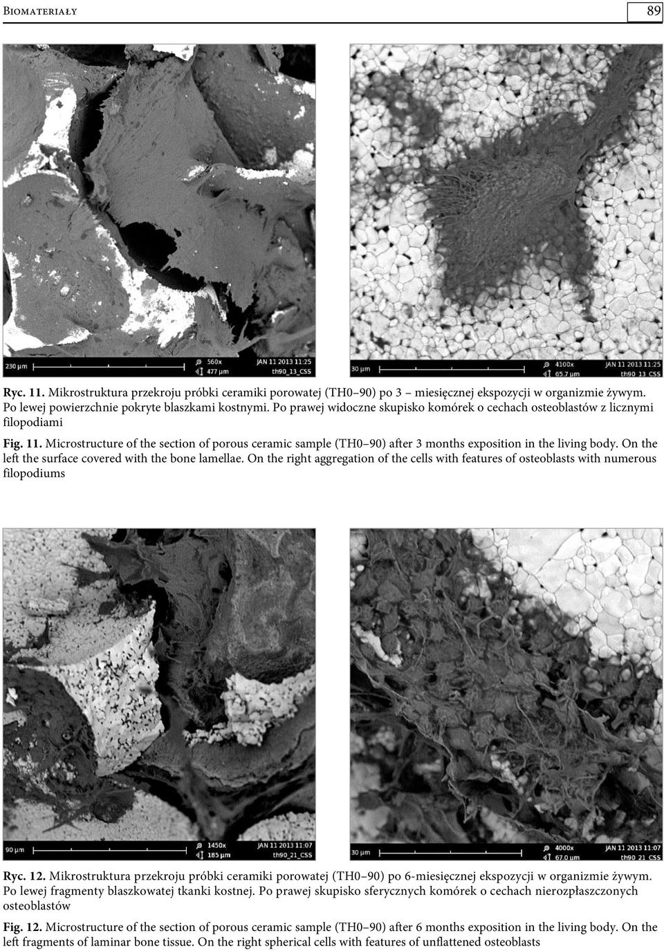On the left the surface covered with the bone lamellae. On the right aggregation of the cells with features of osteoblasts with numerous filopodiums Ryc. 12.