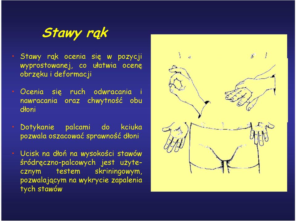 palcami do kciuka pozwala oszacować sprawność dłoni Ucisk na dłoń na wysokości stawów