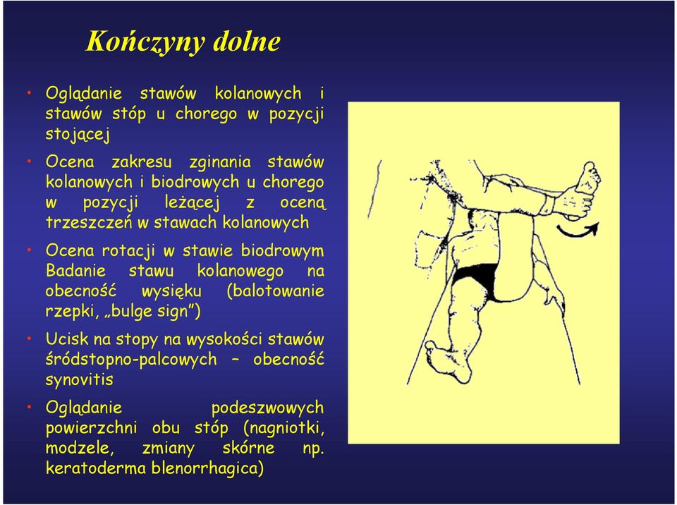 Badanie stawu kolanowego na obecność wysięku (balotowanie rzepki, bulge sign ) Ucisk na stopy na wysokości stawów