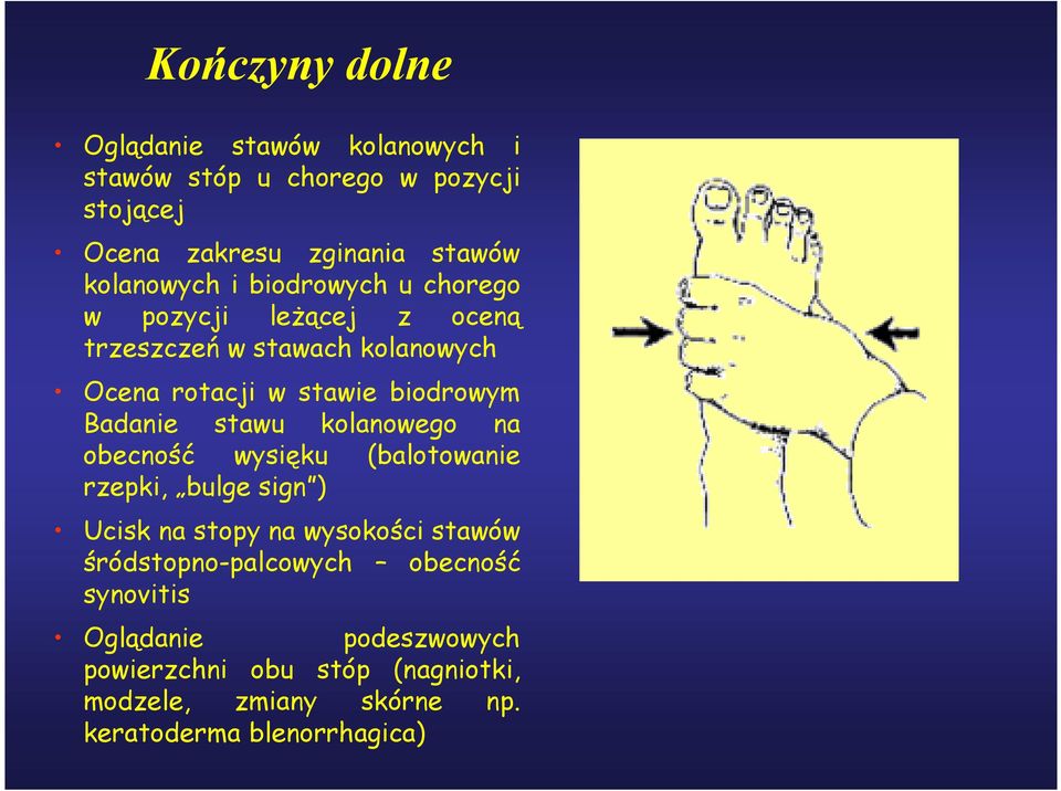 Badanie stawu kolanowego na obecność wysięku (balotowanie rzepki, bulge sign ) Ucisk na stopy na wysokości stawów