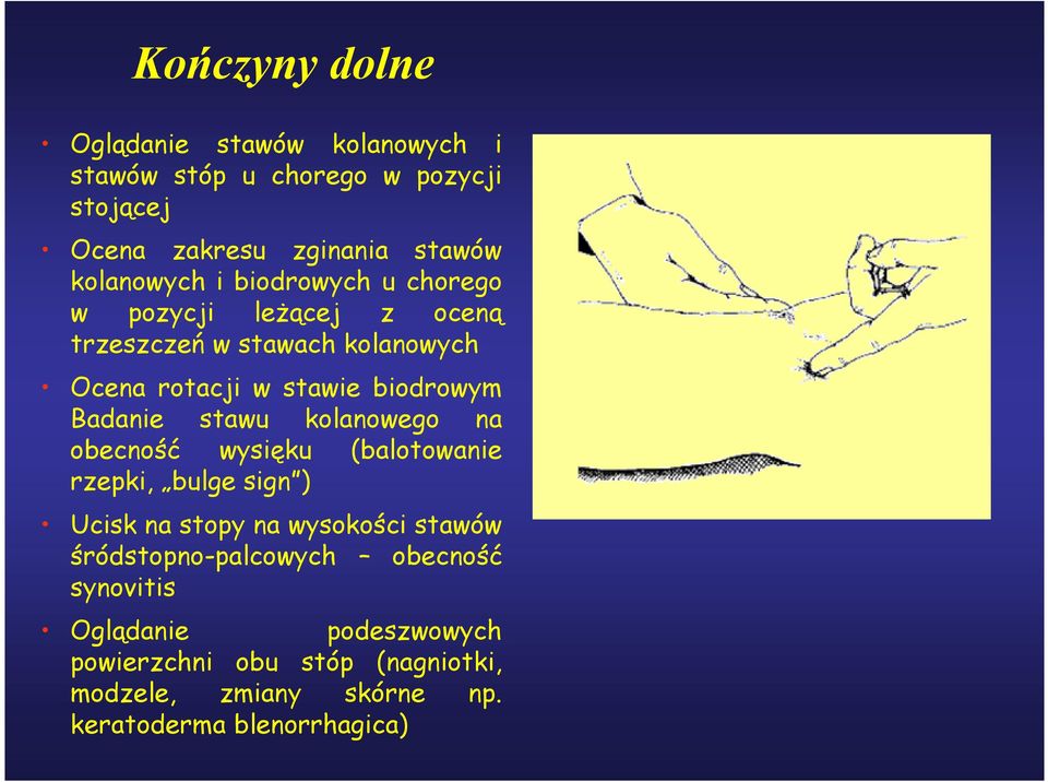 Badanie stawu kolanowego na obecność wysięku (balotowanie rzepki, bulge sign ) Ucisk na stopy na wysokości stawów