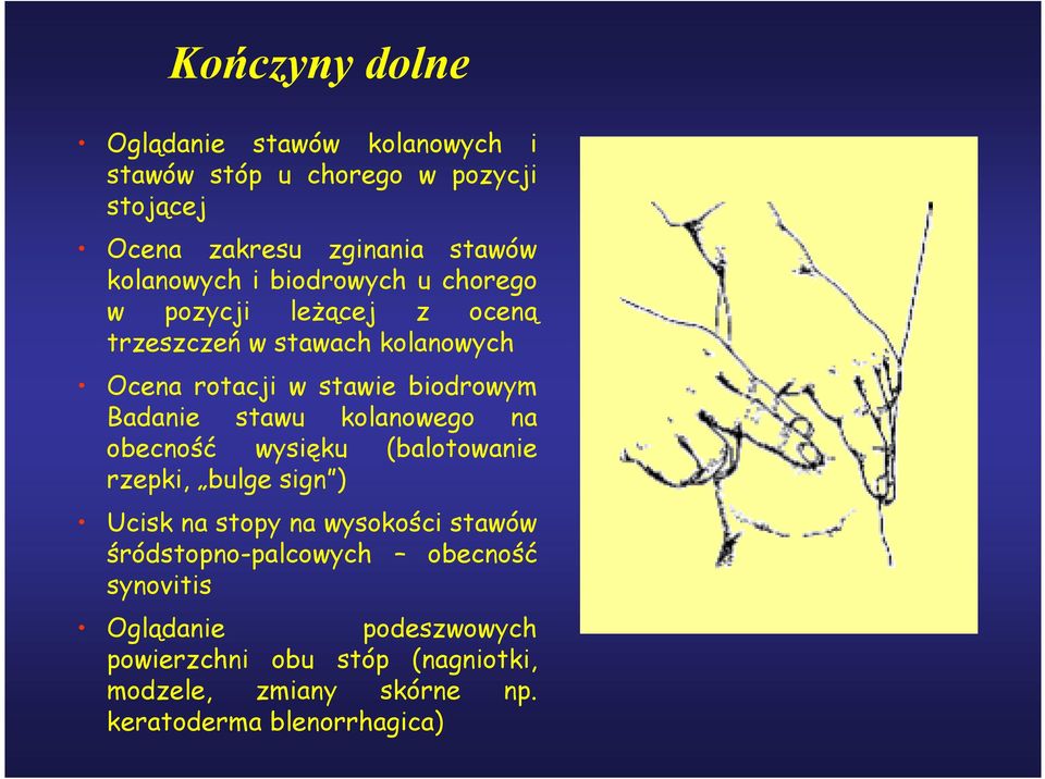 Badanie stawu kolanowego na obecność wysięku (balotowanie rzepki, bulge sign ) Ucisk na stopy na wysokości stawów