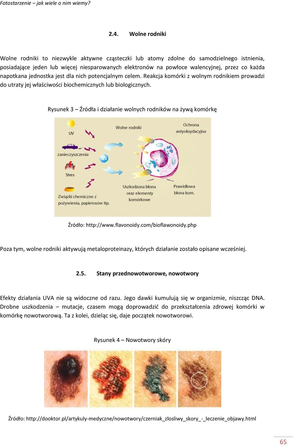 Rysunek 3 Źródła i działanie wolnych rodników na żywą komórkę Źródło: http://www.flavonoidy.com/bioflawonoidy.