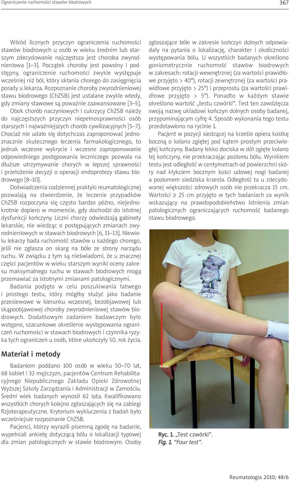 Rozpoznanie choroby zwyrodnieniowej stawu biodrowego (ChZSB) jest ustalane zwykle wtedy, gdy zmiany stawowe są poważnie zaawansowane [3 5].
