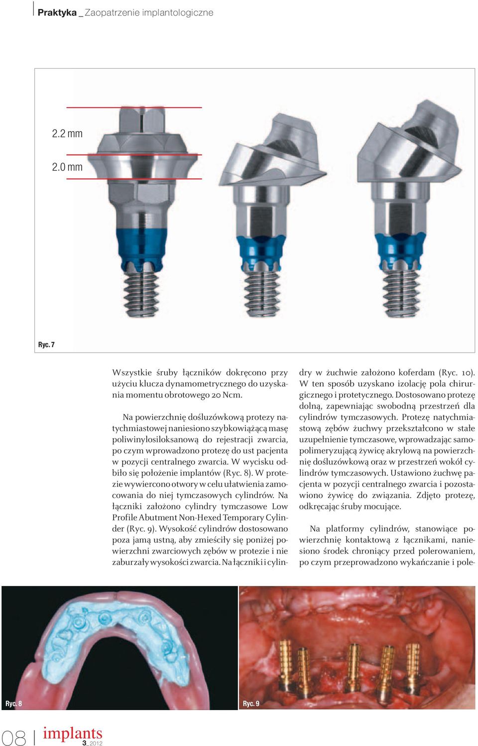 zwarcia. W wycisku odbiło się położenie implantów (Ryc. 8). W protezie wywiercono otwory w celu ułatwienia zamocowania do niej tymczasowych cylindrów.