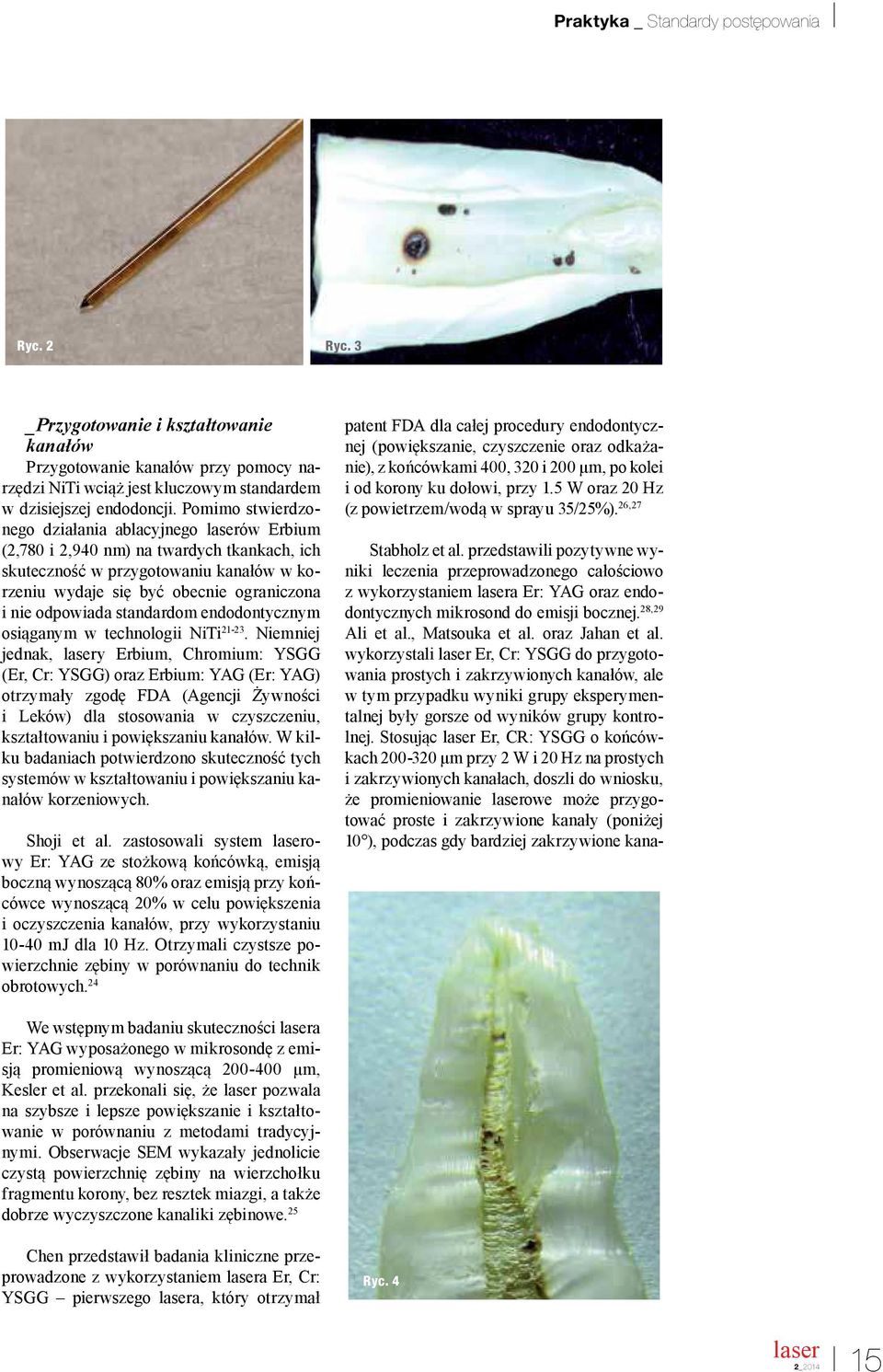 standardom endodontycznym osiąganym w technologii NiTi 21-23.
