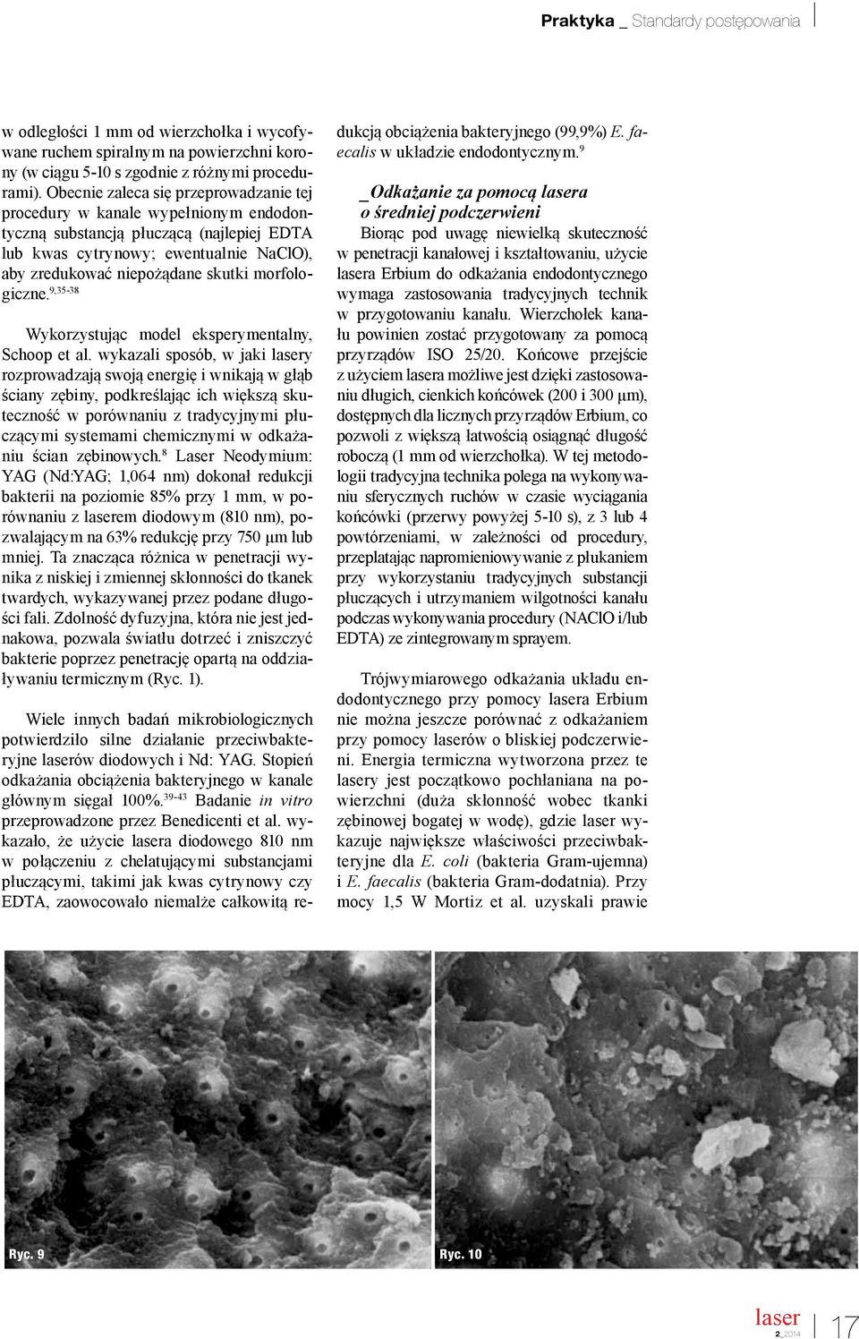morfologiczne. 9,35-38 Wykorzystując model eksperymentalny, Schoop et al.