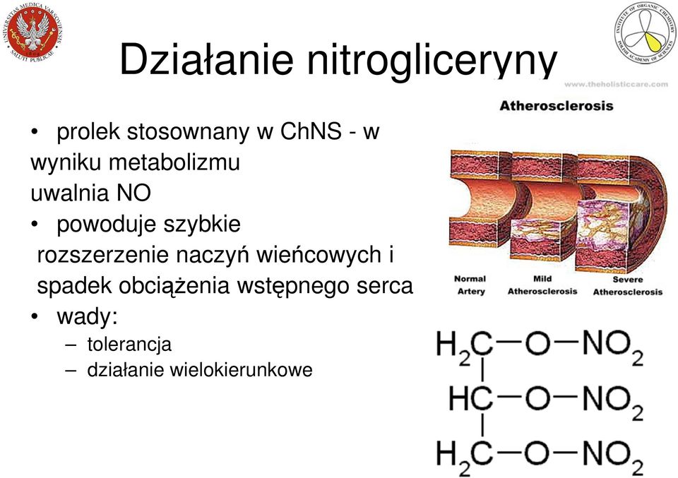 rozszerzenie naczyń wieńcowych i spadek obciążenia