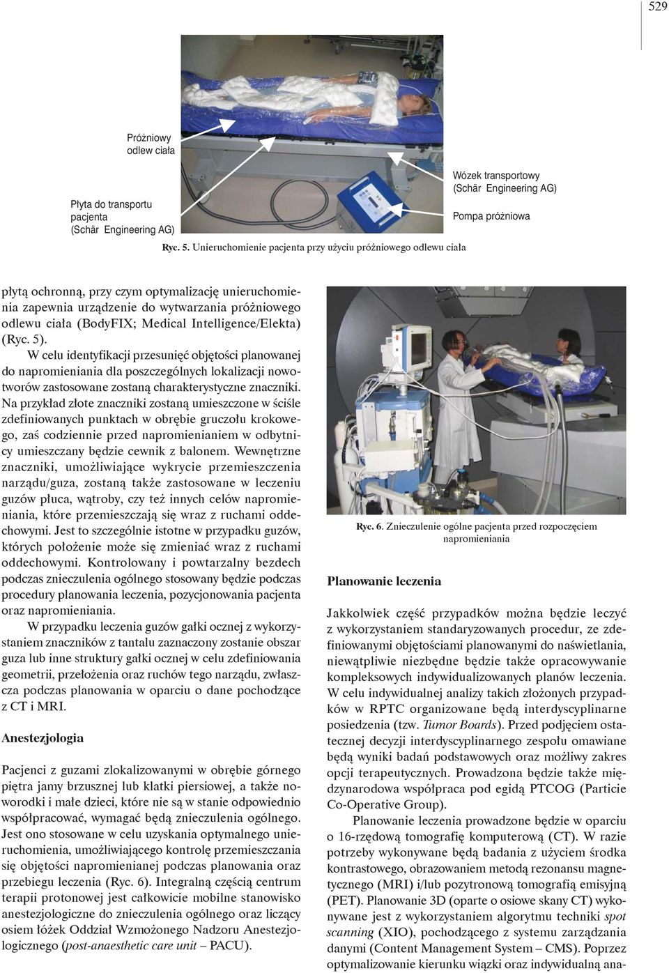 Intelligence/Elekta) (Ryc. 5). W celu identyfikacji przesunięć objętości planowanej do napromieniania dla poszczególnych lokalizacji nowotworów zastosowane zostaną charakterystyczne znaczniki.