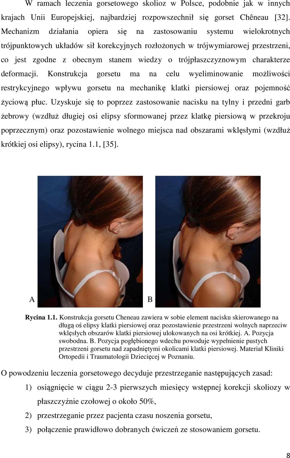 trójpłaszczyznowym charakterze deformacji. Konstrukcja gorsetu ma na celu wyeliminowanie możliwości restrykcyjnego wpływu gorsetu na mechanikę klatki piersiowej oraz pojemność życiową płuc.