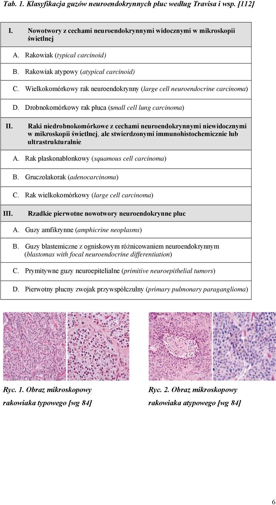 Raki niedrobnokomórkowe z cechami neuroendokrynnymi niewidocznymi w mikroskopii świetlnej, ale stwierdzonymi immunohistochemicznie lub ultrastrukturalnie A.