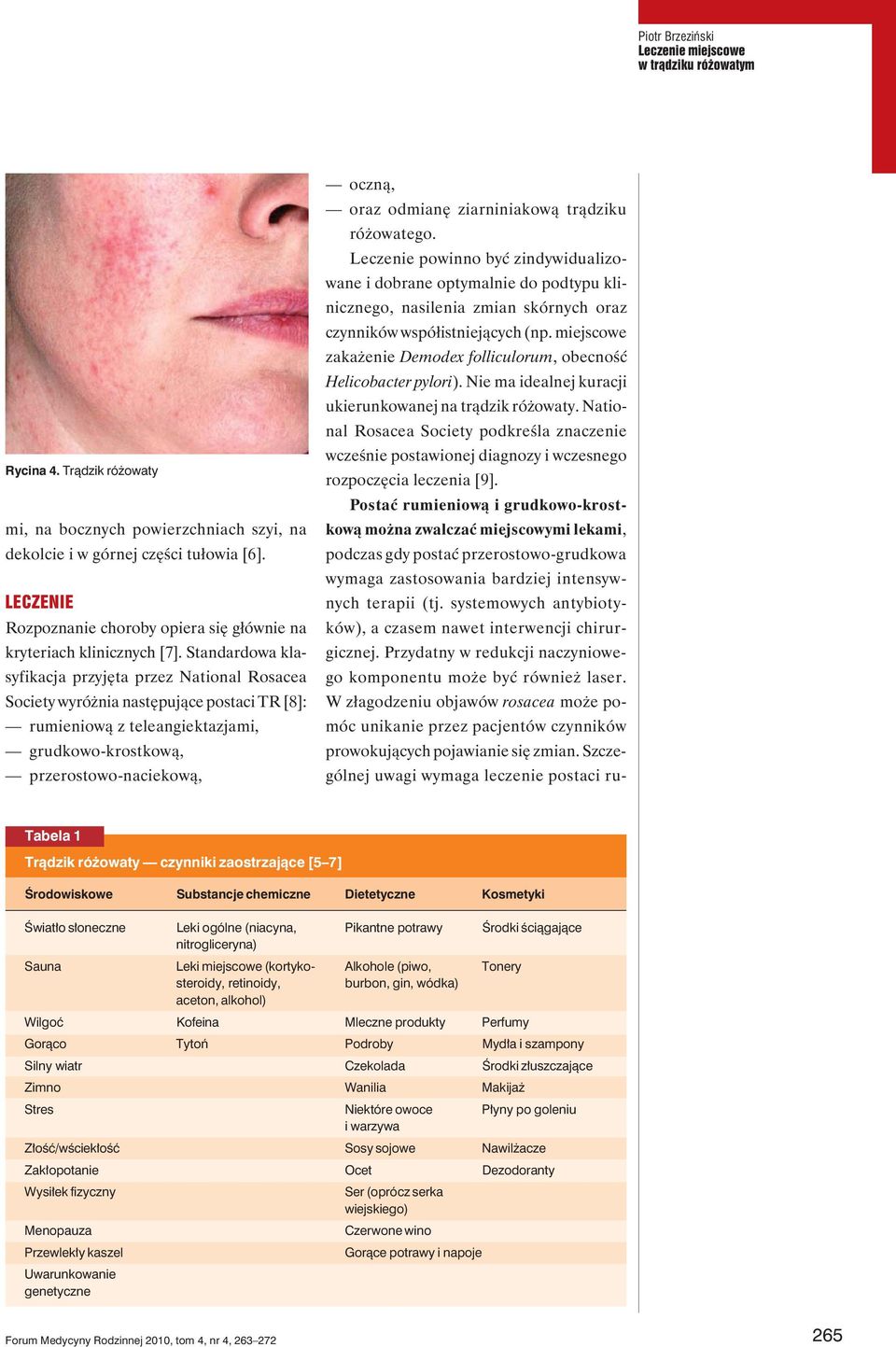 Standardowa klasyfikacja przyjęta przez National Rosacea Society wyróżnia następujące postaci TR [8]: rumieniową z teleangiektazjami, grudkowo-krostkową, przerostowo-naciekową, oczną, oraz odmianę