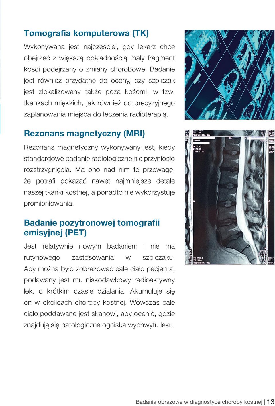 Rezonans magnetyczny (MRI) Rezonans magnetyczny wykonywany jest, kiedy standardowe badanie radiologiczne nie przyniosło rozstrzygnięcia.