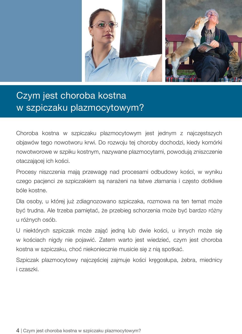 Procesy niszczenia mają przewagę nad procesami odbudowy kości, w wyniku czego pacjenci ze szpiczakiem są narażeni na łatwe złamania i często dotkliwe bóle kostne.