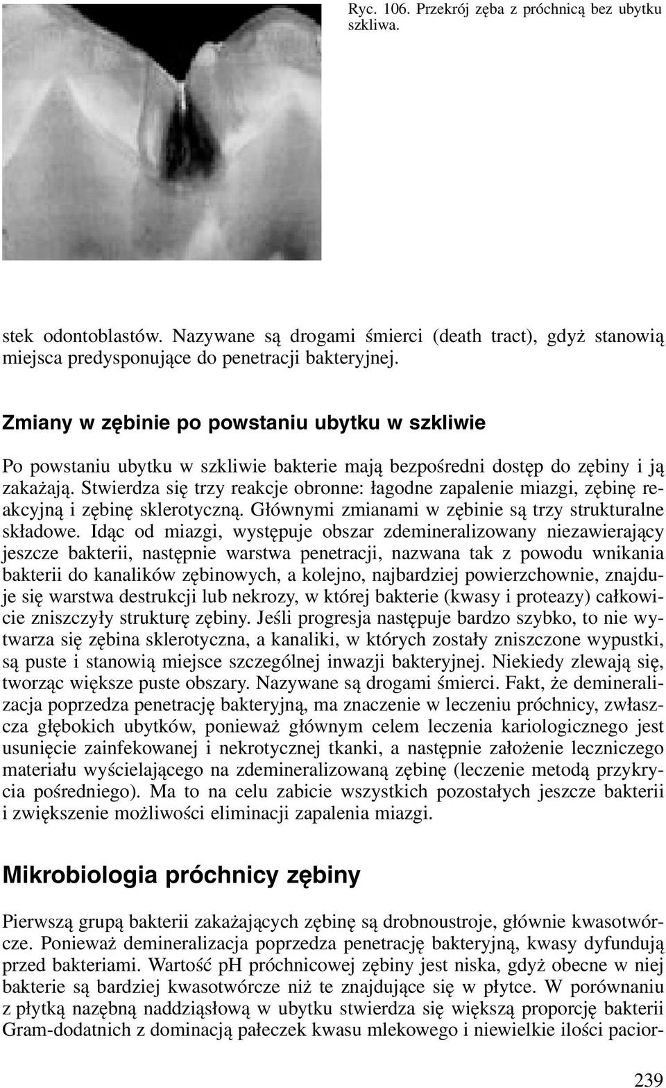 Stwierdza się trzy reakcje obronne: łagodne zapalenie miazgi, zębinę reakcyjną i zębinę sklerotyczną. Głównymi zmianami w zębinie są trzy strukturalne składowe.