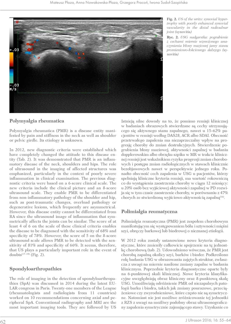 USG nadgarstka: pogrubienie z cechami miernie wzmożonego unaczynienia błony maziowej jamy stawu promieniowo-łokciowego dalszego (synovitis) Polymyalgia rheumatica Polymyalgia rheumatica (PMR) is a