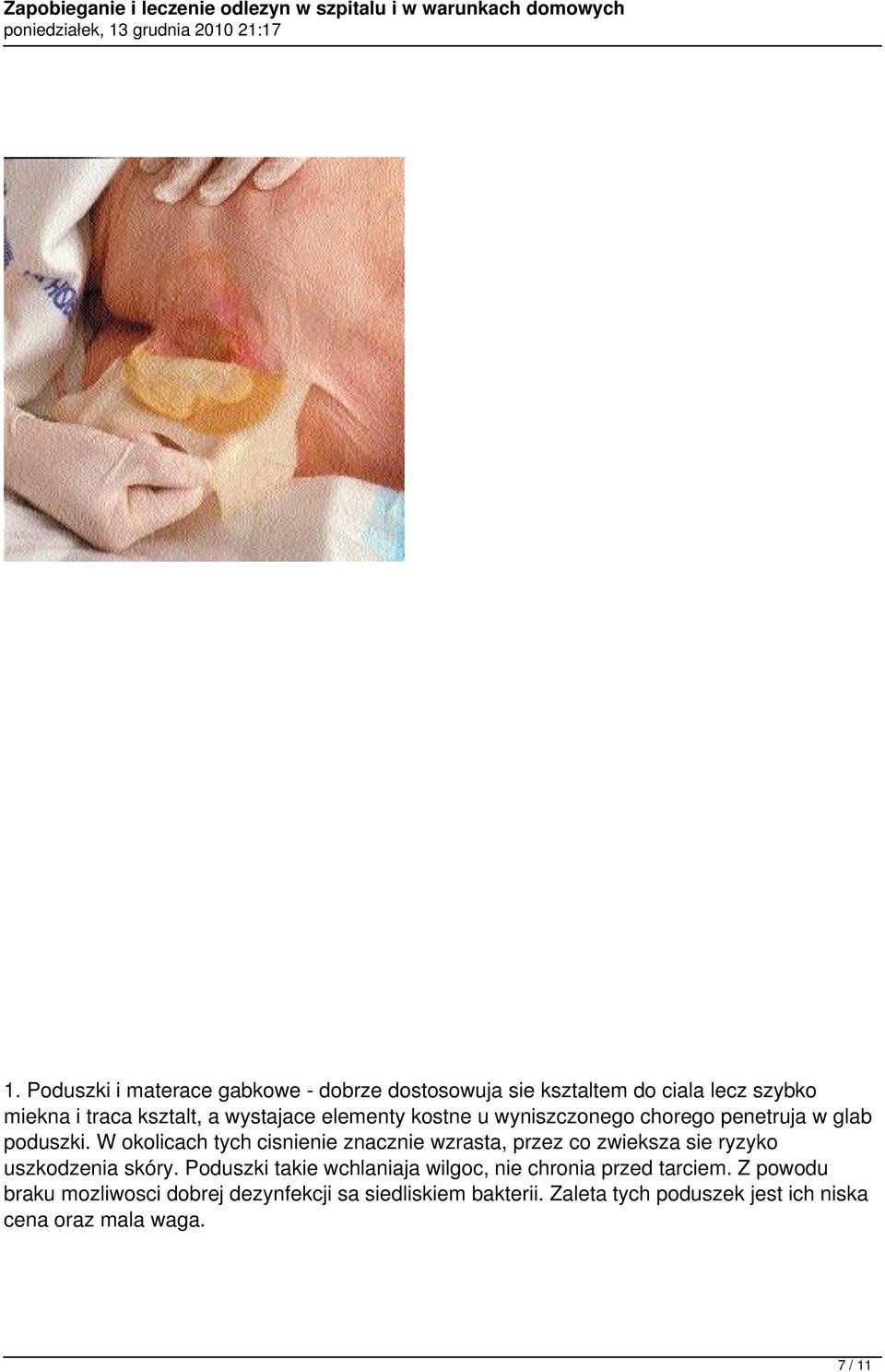 W okolicach tych cisnienie znacznie wzrasta, przez co zwieksza sie ryzyko uszkodzenia skóry.