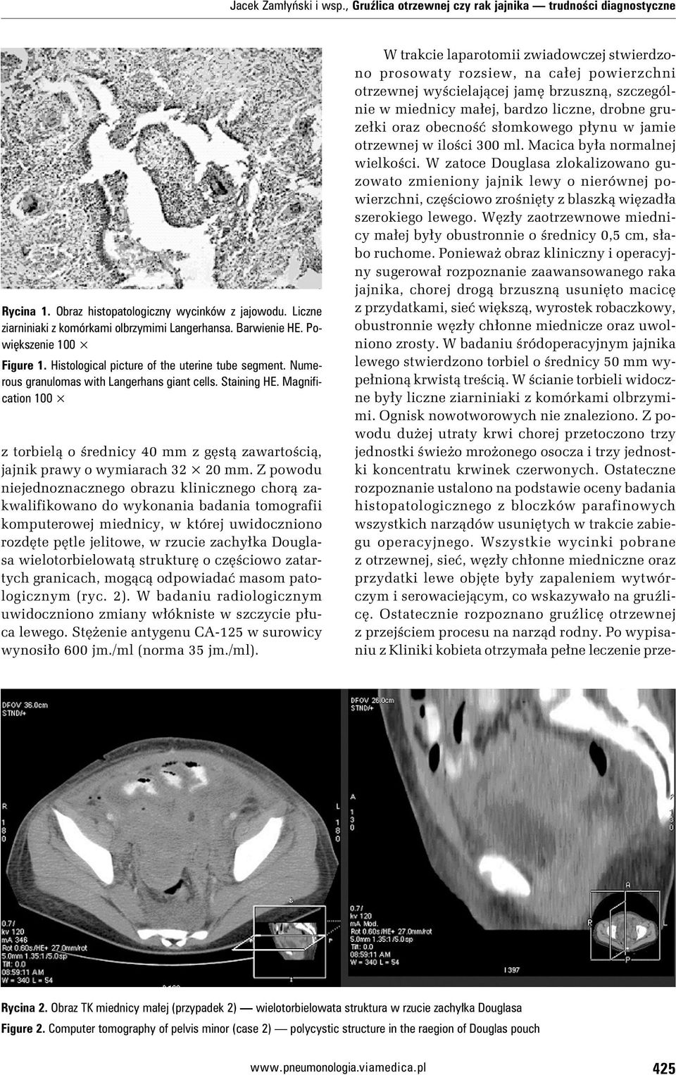 Magnification 100 z torbielą o średnicy 40 mm z gęstą zawartością, jajnik prawy o wymiarach 32 20 mm.