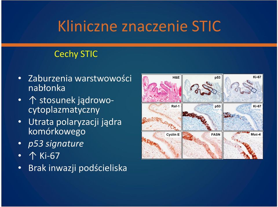 jądrowocytoplazmatyczny Utrata polaryzacji