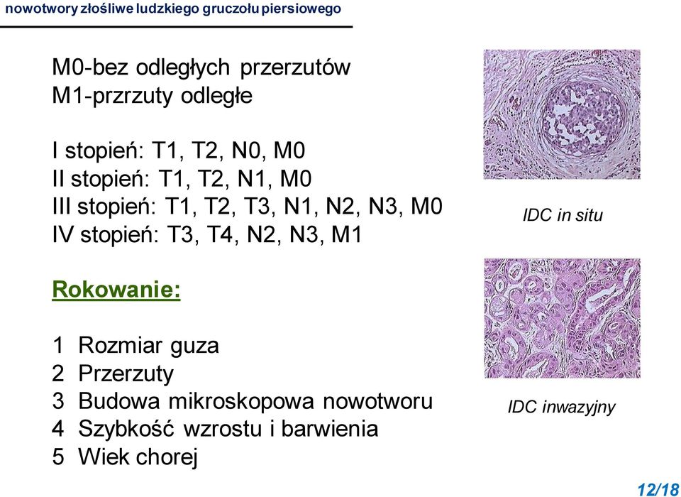 N2, N3, M0 IV stopień: T3, T4, N2, N3, M1 IDC in situ Rokowanie: 1 Rozmiar guza 2 Przerzuty