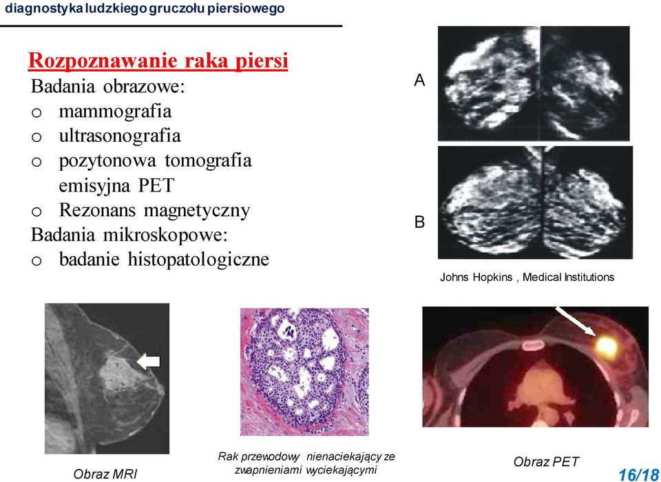 magnetyczny Badania mikroskopowe: o badanie histopatologiczne A B Johns Hopkins, Medical