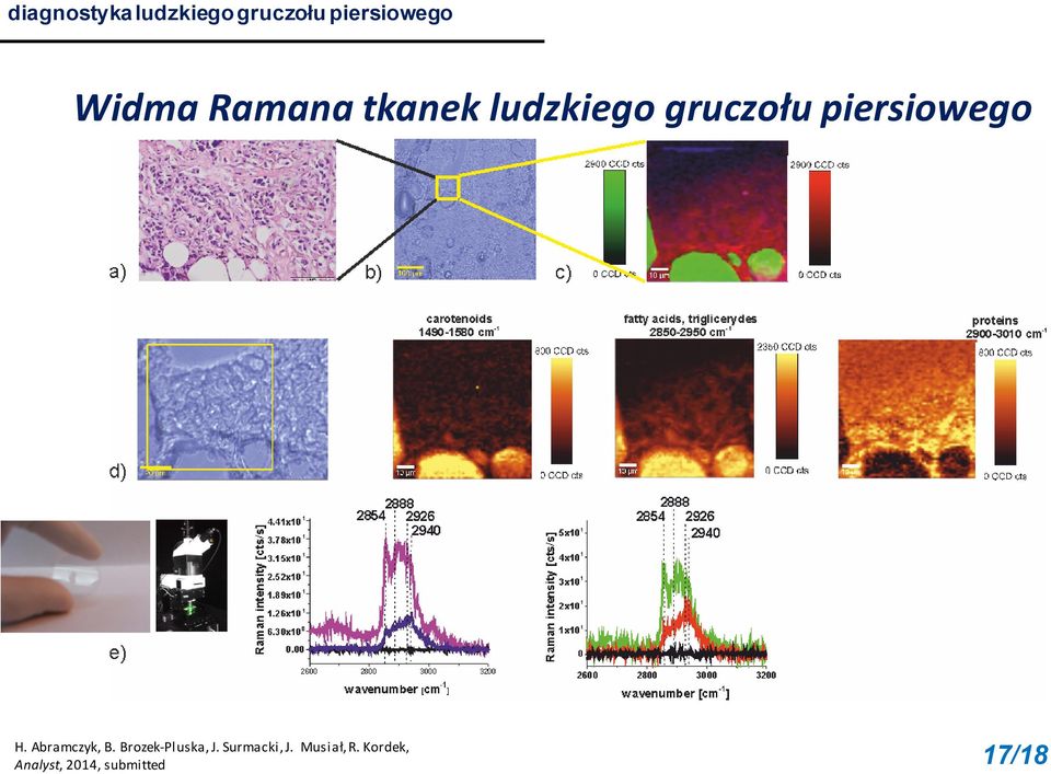 piersiowego H. Abramczyk, B. Brozek-Pluska, J.