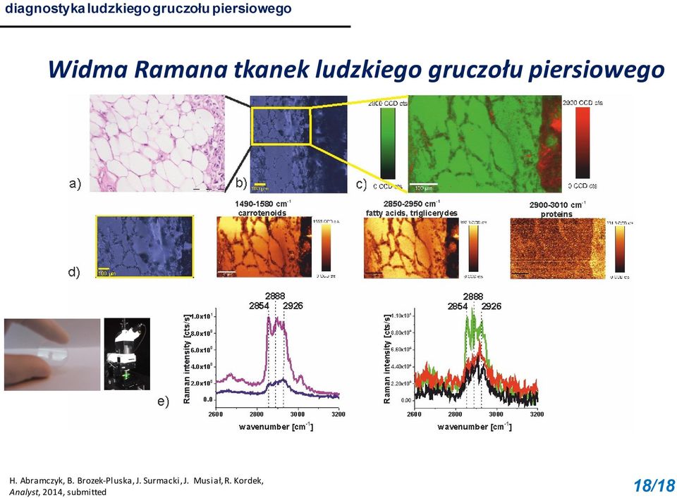 piersiowego H. Abramczyk, B. Brozek-Pluska, J.