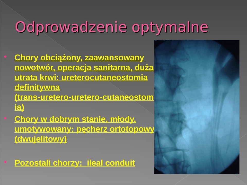 (trans-uretero-uretero-cutaneostom ia) Chory w dobrym stanie, młody,