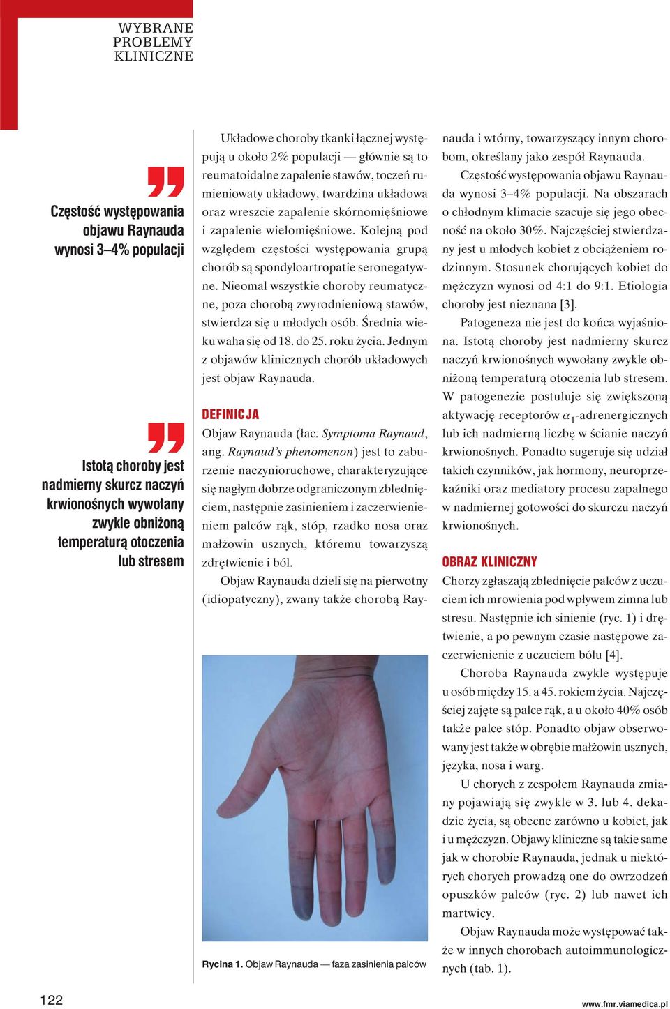 oraz wreszcie zapalenie skórnomięśniowe i zapalenie wielomięśniowe. Kolejną pod względem częstości występowania grupą chorób są spondyloartropatie seronegatywne.