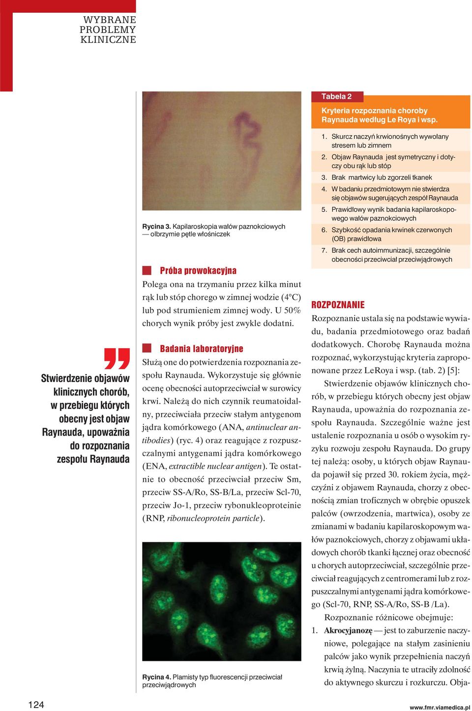 U 50% chorych wynik próby jest zwykle dodatni. Badania laboratoryjne Służą one do potwierdzenia rozpoznania zespołu Raynauda. Wykorzystuje się głównie ocenę obecności autoprzeciwciał w surowicy krwi.