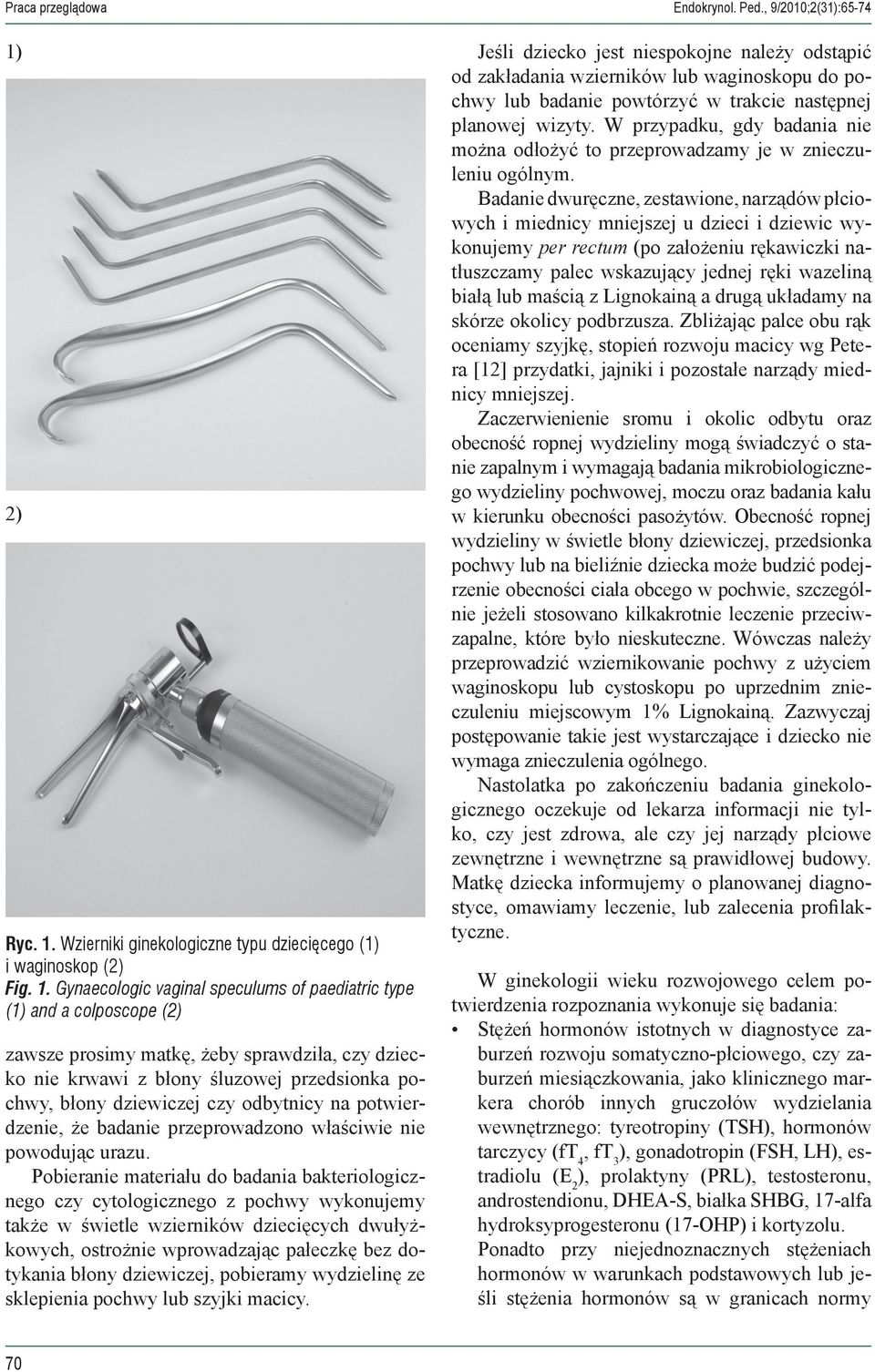 Wzierniki ginekologiczne typu dziecięcego (1) i waginoskop (2) Fig. 1.