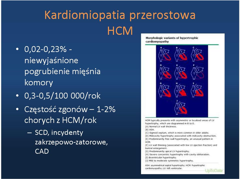 0,3-0,5/100 000/rok Częstość zgonów 1-2%