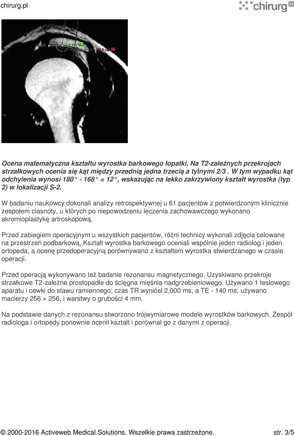 W badaniu naukowcy dokonali analizy retrospektywnej u 61 pacjentów z potwierdzonym klinicznie zespołem ciasnoty, u których po niepowodzeniu leczenia zachowawczego wykonano akromioplastykę