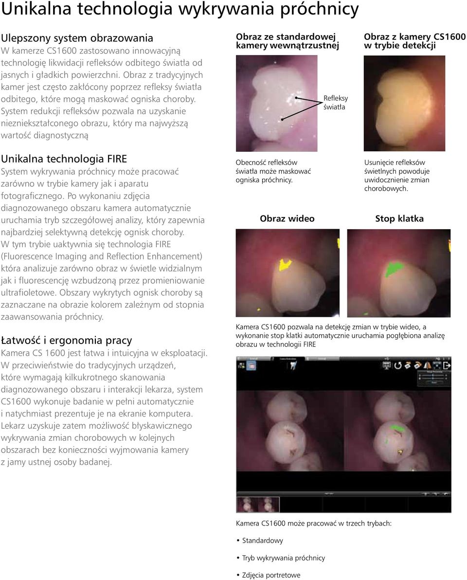 System redukcji refleksów pozwala na uzyskanie niezniekształconego obrazu, który ma najwyższą wartość diagnostyczną Obraz ze standardowej kamery wewnątrzustnej Refleksy światła Obraz z kamery CS1600