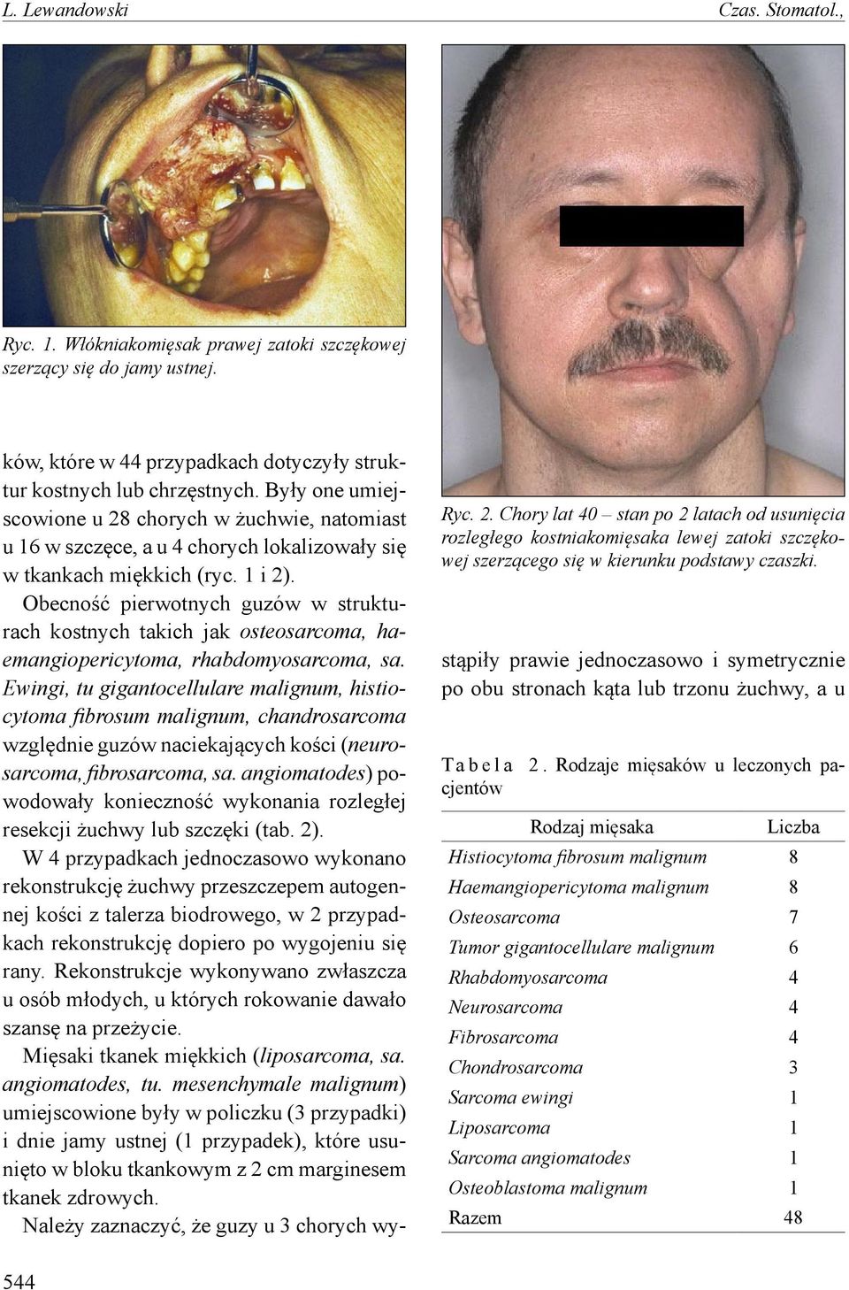 ków, które w 44 przypadkach dotyczyły struktur kostnych lub chrzęstnych.