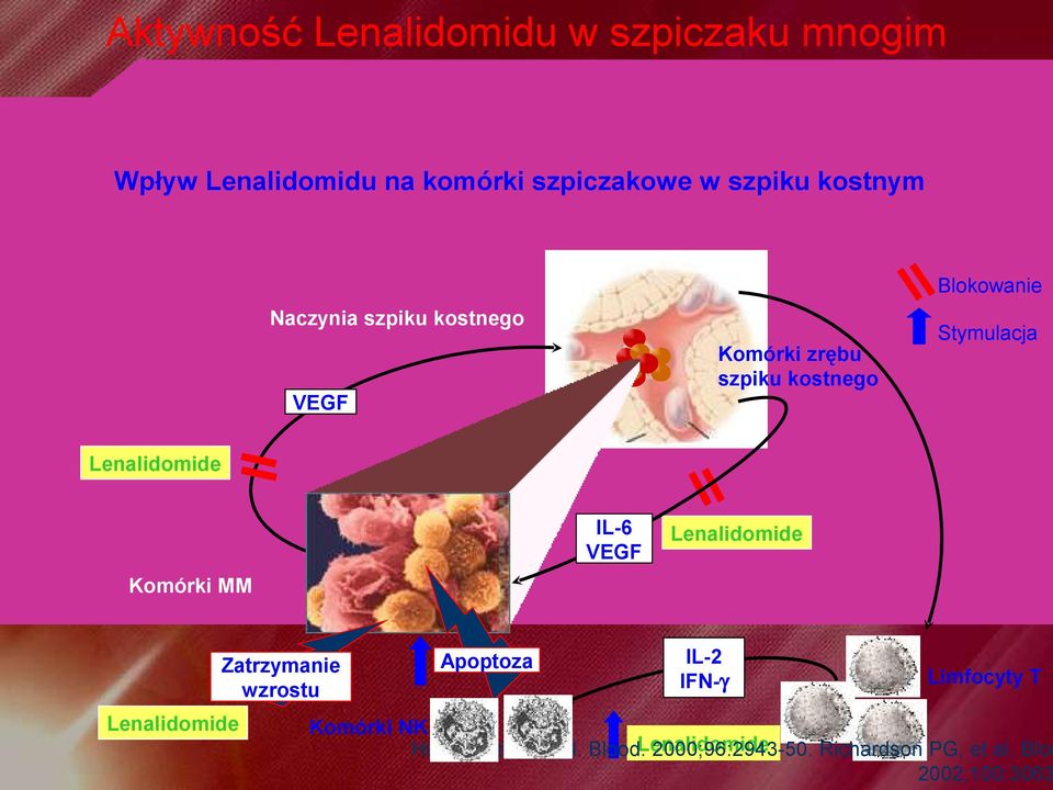 Komórki MM IL-6 VEGF Lenalidomide Lenalidomide Zatrzymanie wzrostu Apoptoza IL-2 IFN-γ Limfocyty T