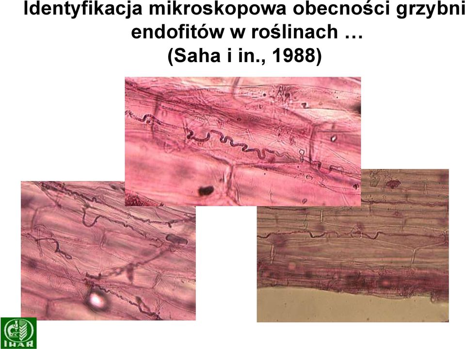 obecności grzybni