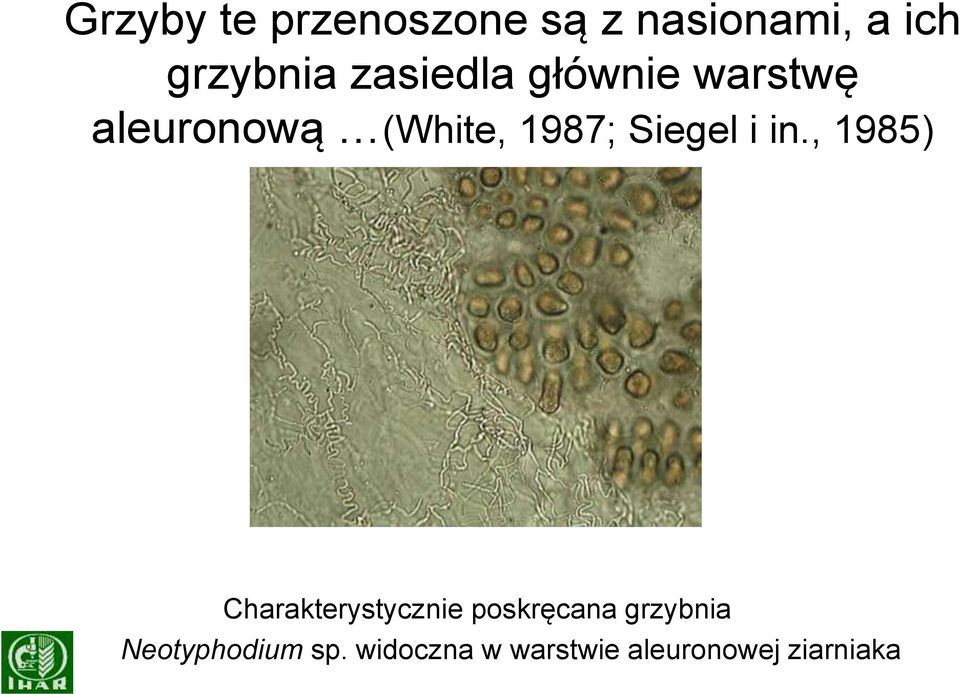 Siegel i in, 1985) Charakterystycznie poskręcana