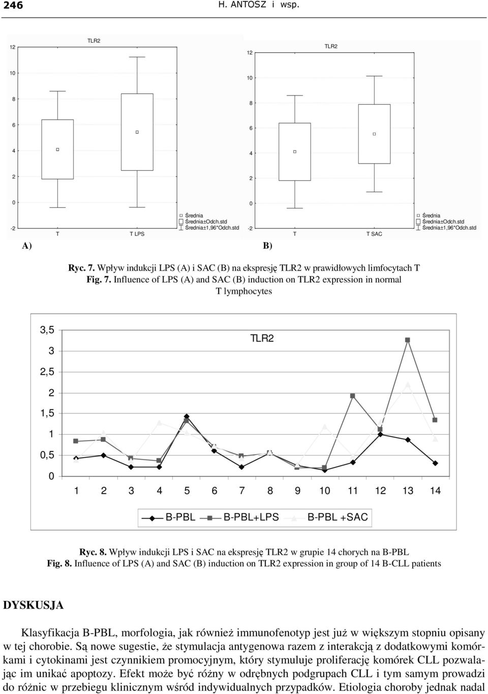 8. Influence of LPS (A) and SAC (B) induction on expression in group of 1 B-CLL patients DYSKUSJA Klasyfikacja B-PBL, morfologia, jak równieŝ immunofenotyp jest juŝ w większym stopniu opisany w tej