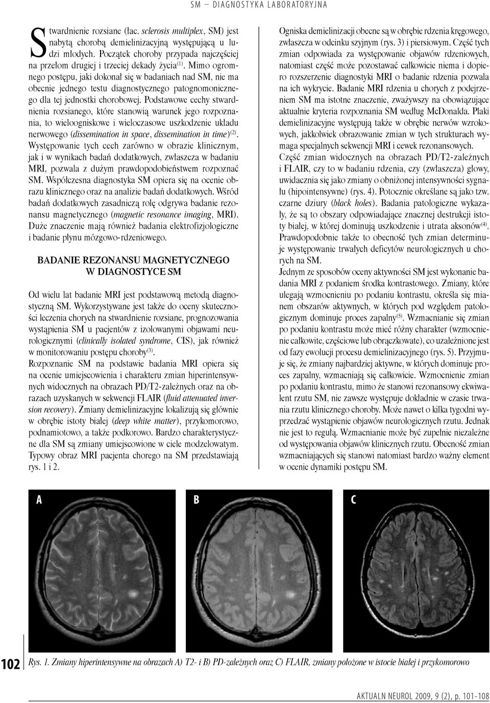 Mimo ogromnego postępu, jaki dokonał się w badaniach nad SM, nie ma obecnie jednego testu diagnostycznego patognomonicznego dla tej jednostki chorobowej.