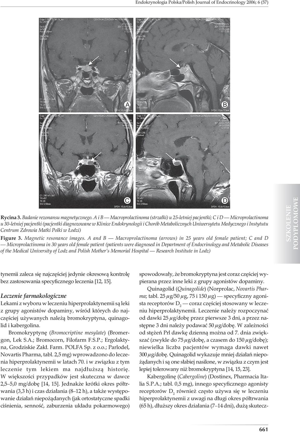 Medycznego i Instytutu Centrum Zdrowia Matki Polki w Łodzi) Figure 3. Magnetic resonance images.