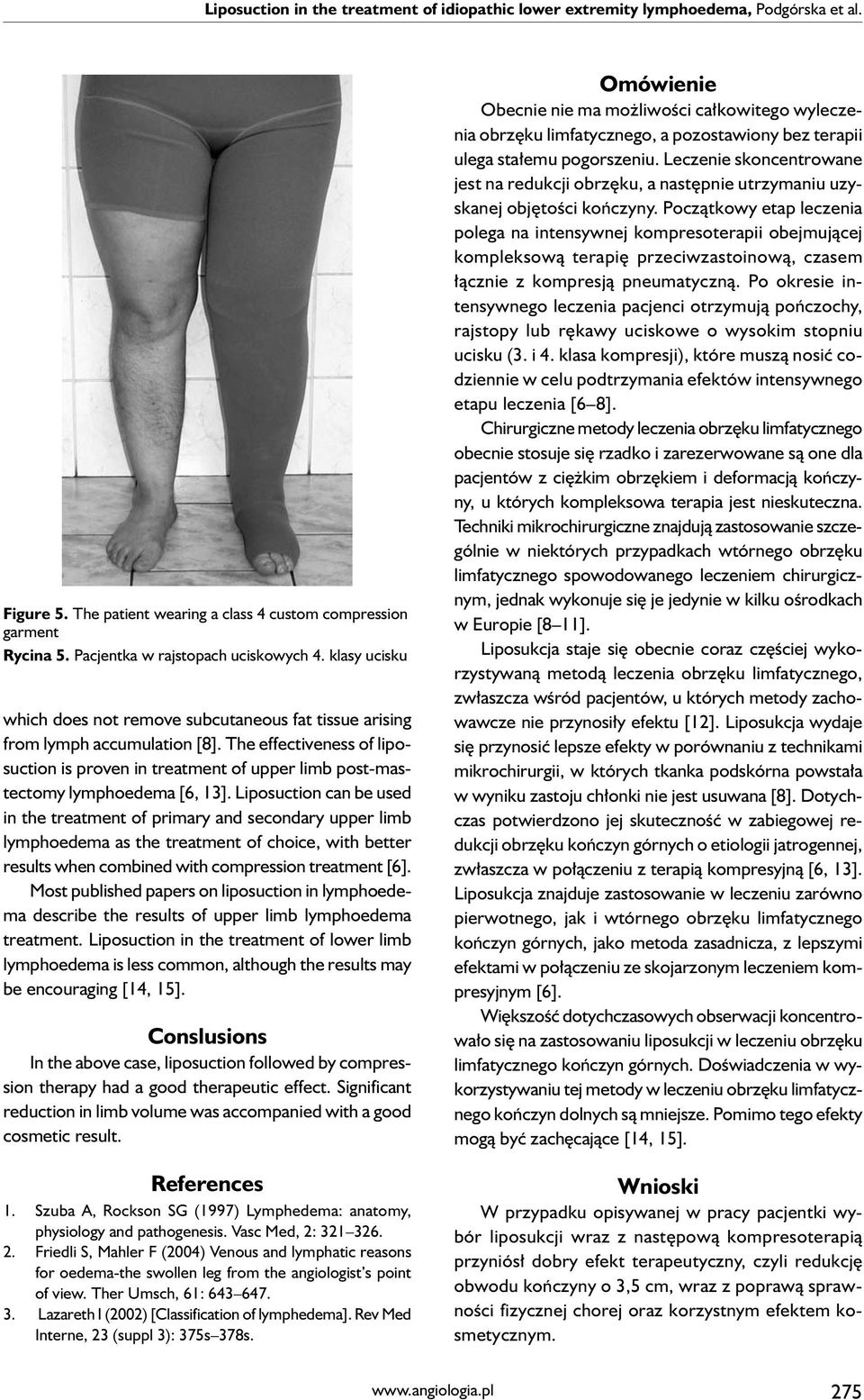 The effectiveness of liposuction is proven in treatment of upper limb post-mastectomy lymphoedema [6, 13].