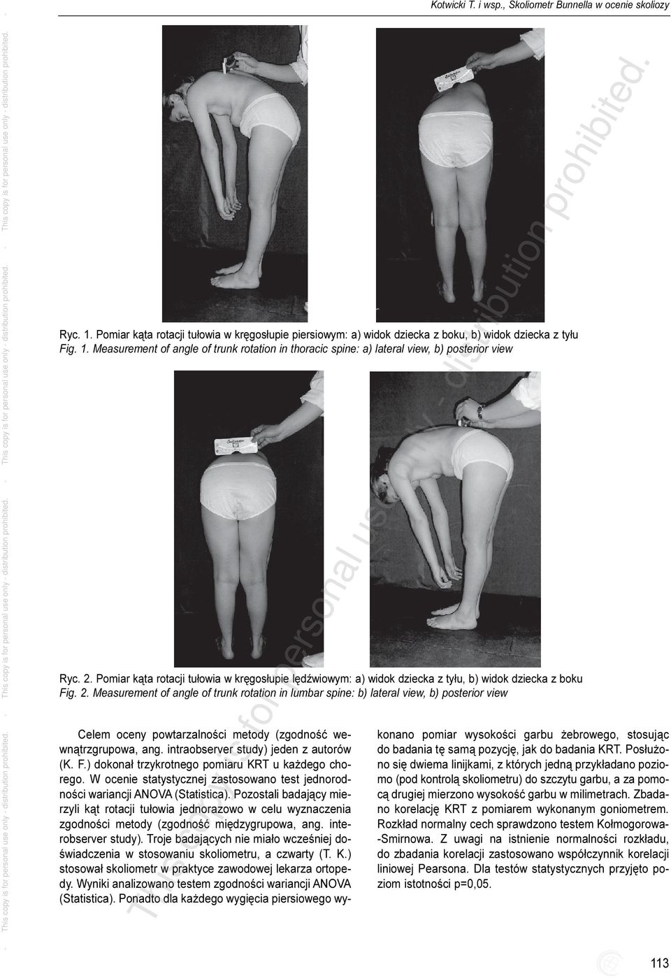 Measurement of angle of trunk rotation in lumbar spine: b) lateral view, b) posterior view Celem oceny powtarzalnoœci metody (zgodnoœæ wewn¹trzgrupowa, ang. intraobserver study) jeden z autorów (K. F.
