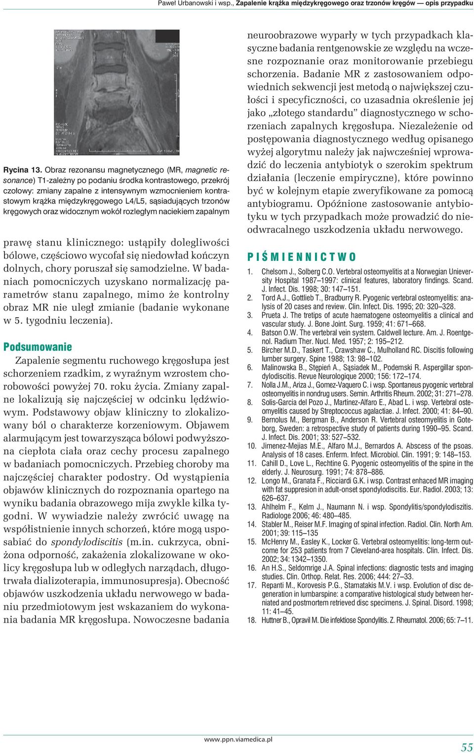 L4/L5, sąsiadujących trzonów kręgowych oraz widocznym wokół rozległym naciekiem zapalnym prawę stanu klinicznego: ustąpiły dolegliwości bólowe, częściowo wycofał się niedowład kończyn dolnych, chory